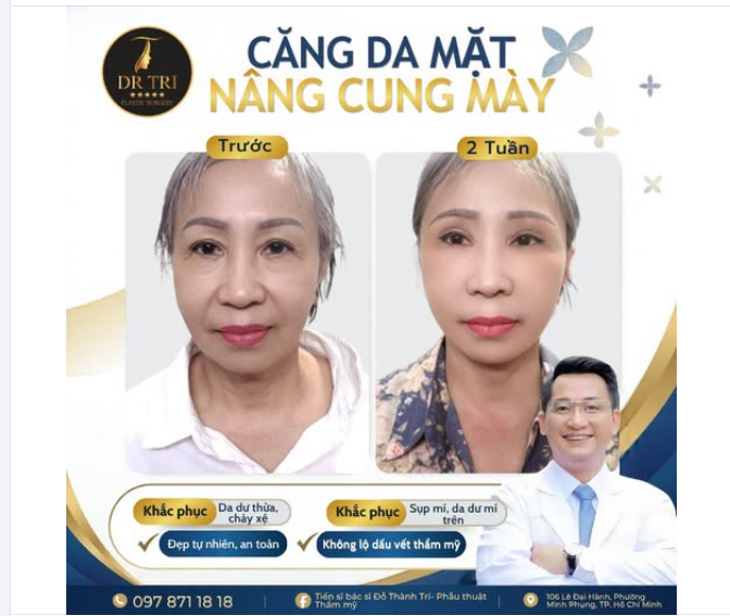 TRẺ HÓA TOÀN DIỆN VỚI COMBO CĂNG DA MẶT NÂNG CUNG MÀY