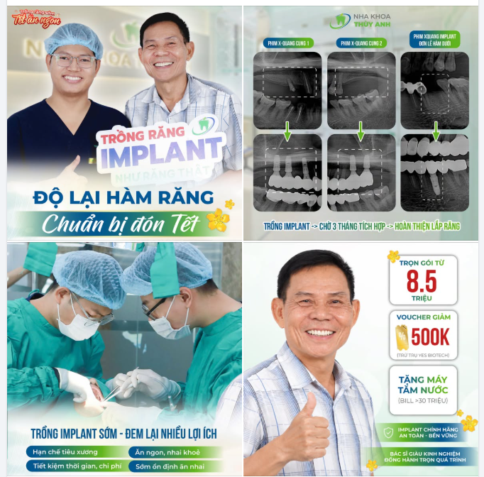 TRỒNG RĂNG KỊP ĐÓN TẾT – ĐỂ NHỮNG BỮA CƠM SUM VẦY THÊM TRỌN VẸN