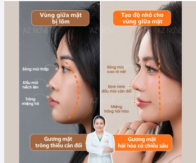 Cùng một góc nghiêng, điều gì tạo nên sự khác biệt