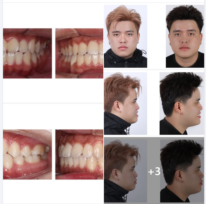 ĐIỀU BẠN QUAN TÂM NHẤT KHI CHỈNH NHA CÓ PHẢI LÀ: BÁC SĨ GIỎI?  VÀ THẬT TUYỆT VỜI KHI VIET SMILE ĐÃ SỞ HỮU ĐỘI NGŨ BÁC SĨ GIỎI VỀ CHỈNH NHA