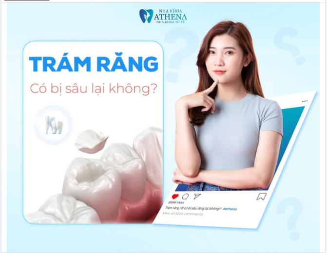 TRÁM RĂNG RỒI CÓ BỊ SÂU LẠI KHÔNG? CÓ THỂ, NẾU VIỀN MIẾNG TRÁM KHÔNG ĐƯỢC CHĂM.