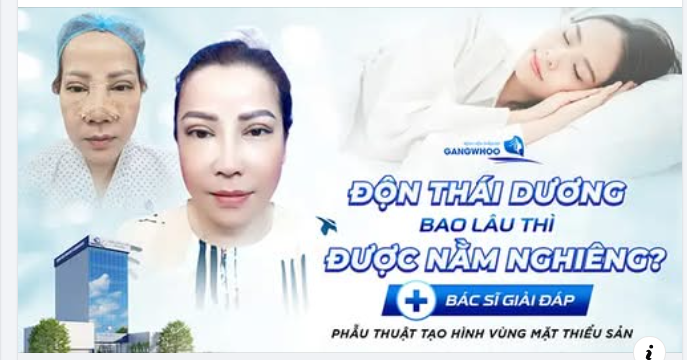 ĐỘN THÁI DƯƠNG BAO LÂU ĐƯỢC NẰM NGHIÊNG? Đây là câu hỏi được nhiều người quan tâm sau khi thực hiện thẩm mỹ vùng thái dương!