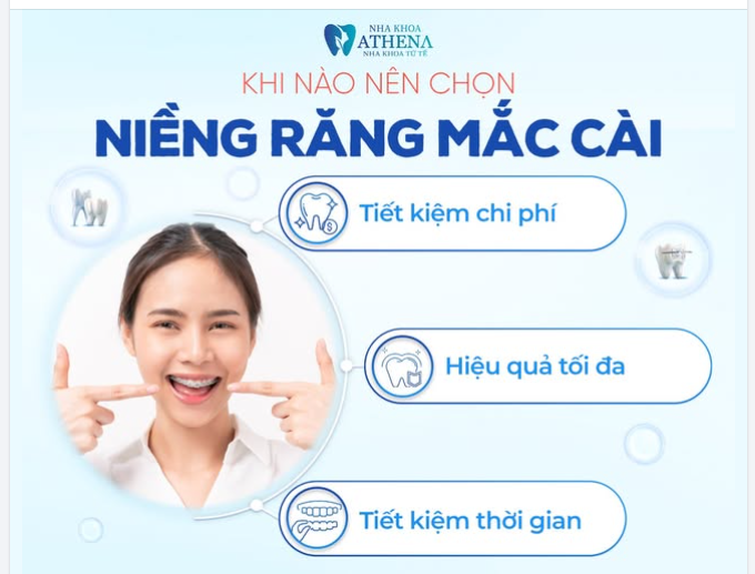 KHI NÀO NÊN CHỌN NIỀNG RĂNG MẮC CÀI? KHI BẠN CẦN BA ĐIỀU NÀY.