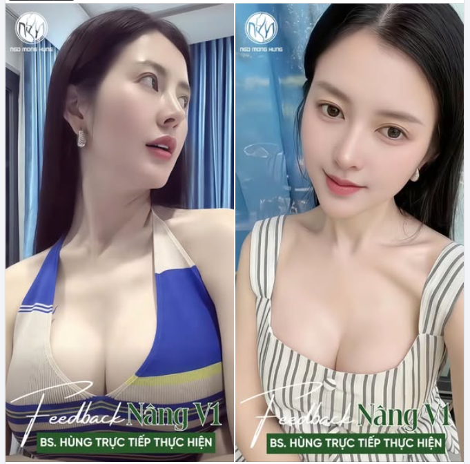 Feedback sau khi đập hộp chiếc túi hiệu mới cho V1!