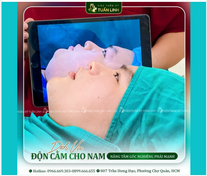 ĐỘN CẰM NAM – NÂNG TẦM GÓC NGHIÊNG, TÔN LÊN NÉT NAM TÍNH PHÁI MẠNH