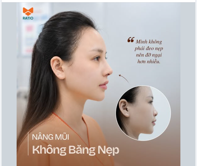 TẠI SAO NHIỀU BẠN SỢ NẸP HƠN CẢ VIỆC NÂNG MŨI?