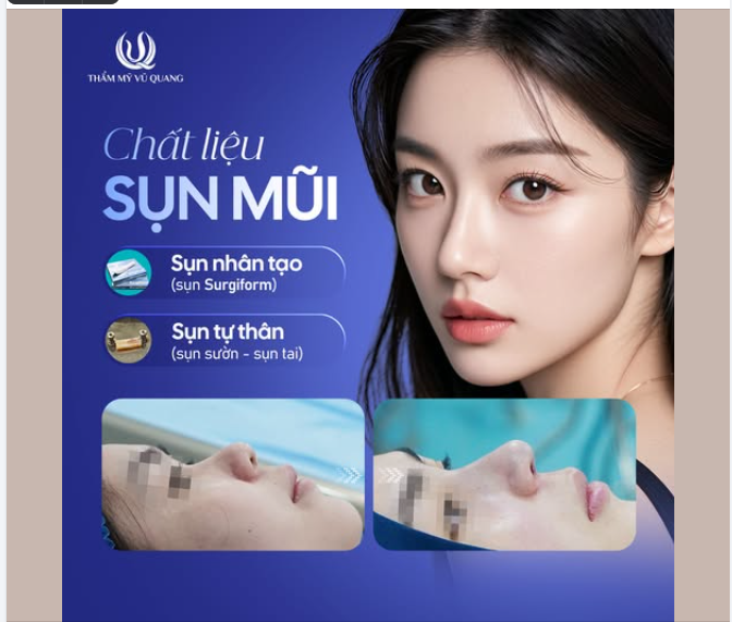 HIỂU VỀ CHẤT LIỆU SỤN MŨI – BẠN ĐÃ CHỌN ĐÚNG LOẠI SỤN CHO MÌNH?