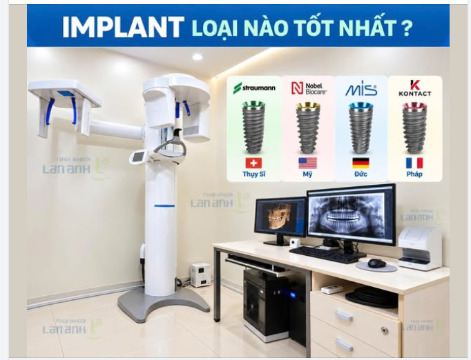 Implant loại nào là tốt nhất?