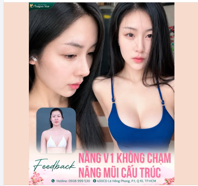 ALO!!! CHO BÁC HOẠT HỎI CỠ NÀY CÓ ĐƯỢC GỌI LÀ "LỘT XÁC" THÀNH CÔNG CHƯA CẢ NHÀ IUUUU