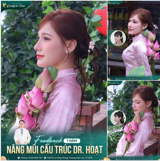 Nàng thơ GenZ của Saigon Star khoe nhan sắc trong veo cùng dáng mũi sắc nét sau hơn 1 năm nâng mũi tại Saigon Star đây ạ!