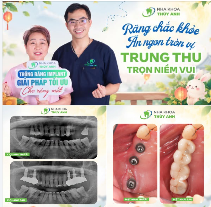 RĂNG KHOẺ ĂN NGON TRÒN VỊ - TRUNG THU TRỌN NIỀM VUI