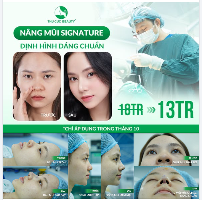 NÂNG MŨI SIGNATURE chỉ trong tháng 10