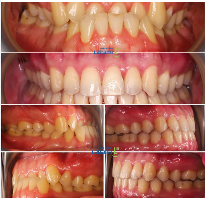 Chỉnh nha - Không chỉ là sắp xếp lại những chiếc răng
