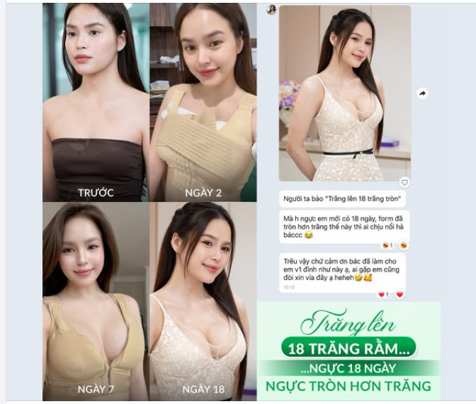 “Tại sao trăng lên 18 trăng tròn, mà ngực 18 ngày vào form còn tròn hơn cả trăng thế này bác sĩ ơi?”
