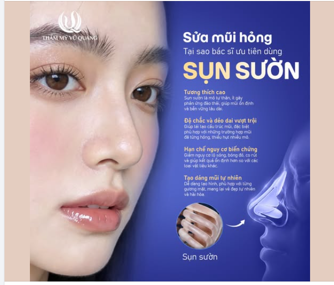 SỬA MŨI HỎNG SỤN SƯỜN: TẠI SAO BÁC SĨ ƯU TIÊN SỬ DỤNG SỤN SƯỜN?