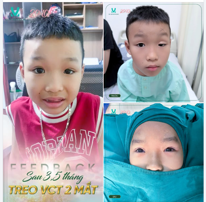 Có những thay đổi nhìn qua tưởng chừng rất nhỏ nhưng với bố mẹ và em bé, đó lại là cả một hành trình đáng nhớ.