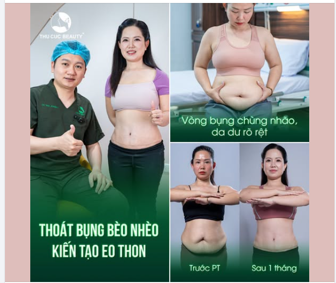 TẠM BIỆT MỠ THỪA CỨNG ĐẦU  THU CÚC TUNG ƯU ĐÃI LỚN THÁNG CỦA PHÁI ĐẸP