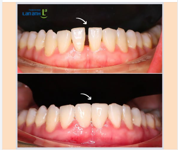 Cùng nhìn lại một sự thay đổi nhẹ nhàng, mang đến nụ cười hài hòa hơn