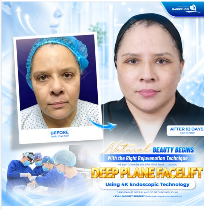 VẺ ĐẸP TỰ NHIÊN BẮT ĐẦU TỪ KỸ THUẬT TRẺ HÓA