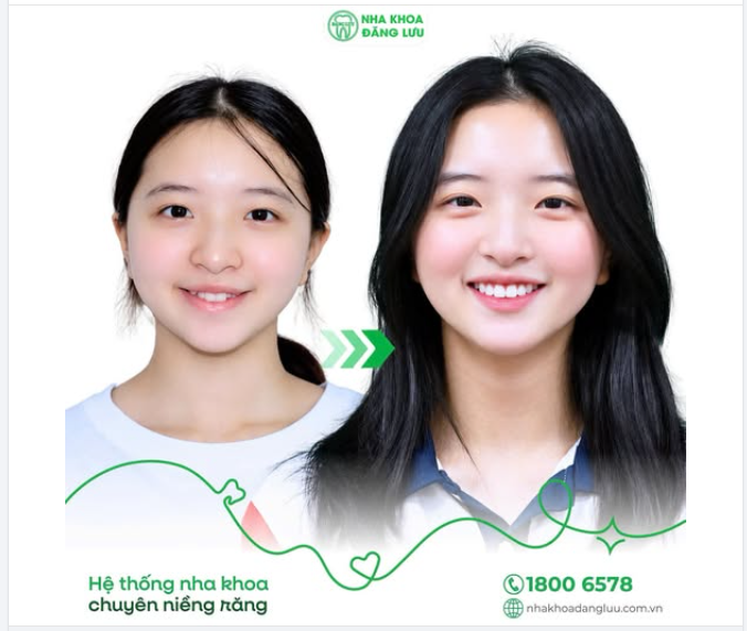 TUI HONG MÊ GÁI, TUI MÊ NHỮNG CÔ GÁI CÓ NỤ CƯỜI XINHHH