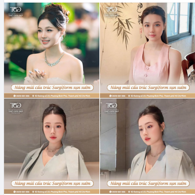 Chạm đến phiên bản rạng rỡ hơn của chính mình sau nâng mũi cấu trúc Barbie-line