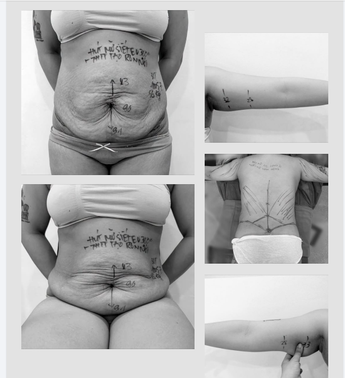 KHÁCH ĐÃ CHỐT COMBO ĐIÊU KHẮC BODY — KẾT QUẢ RA SAO?
