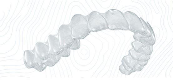 10 lý do vì sao nên chọn niềng răng trong suốt invisalign