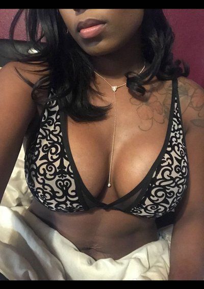 Trải nghiệm làm ngực với túi gel silicon Inspira HP/X 700/750cc ở bà mẹ 2 con cao 1m65, nặng 70kg