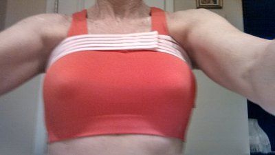 Mẹ đơn thân mắc ung thư da vẫn quyết tâm nâng ngực sau khi đã hoàn thành việc nuôi dạy 2 con