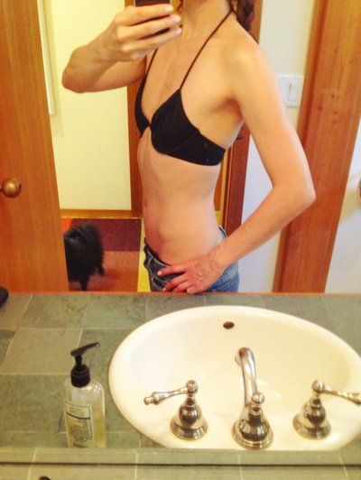 Quá trình nâng cấp vòng 1 của quý bà “team ngực lép” cao 1m72, nặng 56,6 kg