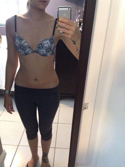 23 tuổi. Nâng ngực bằng túi độn size 400 cc. Đường mổ gần như vô hình ở dưới vú