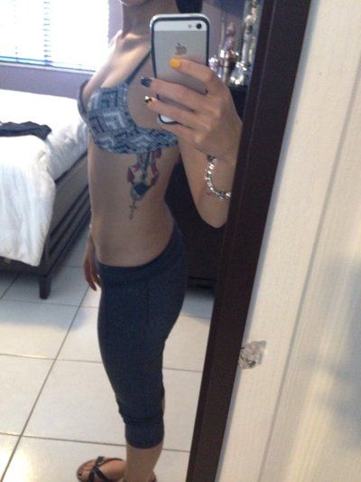 23 tuổi. Nâng ngực bằng túi độn size 400 cc. Đường mổ gần như vô hình ở dưới vú