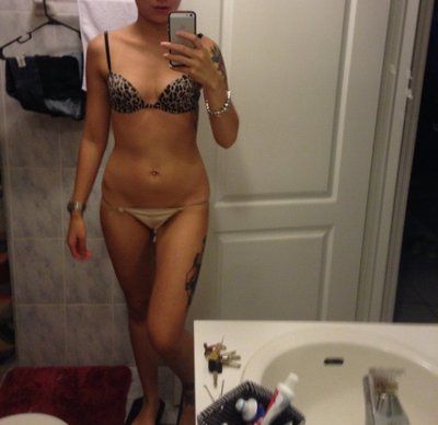 23 tuổi. Nâng ngực bằng túi độn size 400 cc. Đường mổ gần như vô hình ở dưới vú