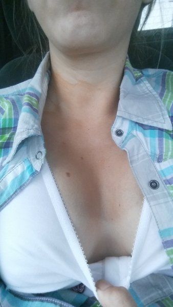 Hành trình nâng ngực của mẹ trẻ 4 con ở độ tuổi 27 tuổi (cao 1m62, ngực ban đầu cỡ 34AA, 4 con, đặt túi độn HP 425cc, dưới cơ)