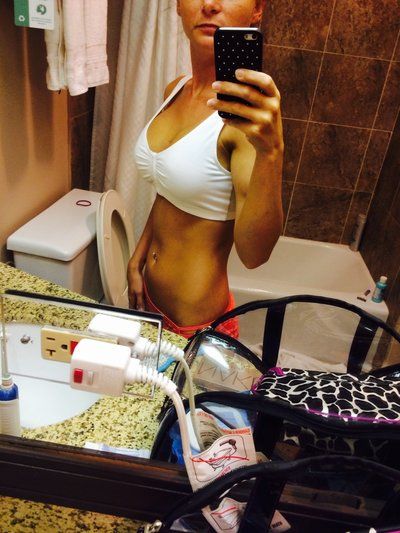 Hành trình nâng ngực bằng túi độn size 350cc của người mẹ 2 con chỉ nặng tròn 41kg