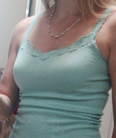 Hành trình nâng cấp vòng một từ size 34B lên size 34DD với túi độn 400cc độ nhô trên trung bình