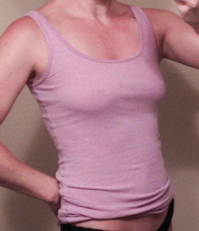 Hành trình nâng cấp vòng một từ size 34B lên size 34DD với túi độn 400cc độ nhô trên trung bình