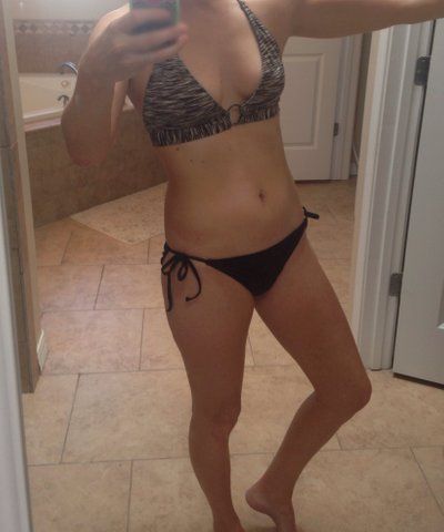 Hành trình nâng cấp vòng một từ size 34B lên size 34DD với túi độn 400cc độ nhô trên trung bình