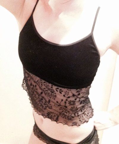 Hành trình nâng cấp vòng một từ size 34B lên size 34DD với túi độn 400cc độ nhô trên trung bình