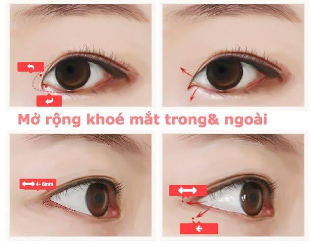 tin 6 ảnh mr góc đuôi mắt