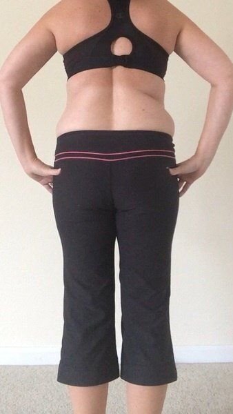 Cùng theo dõi quá trình hút bỡ hai bên hông, sườn và lưng của bà mẹ 46 tuổi