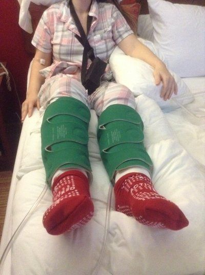 Mẹ 3 con quyết tâm hút mỡ đùi, bắp chân và mắt cá chân