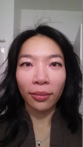 Khuôn mặt thon gọn, đường viền hàm rõ nét sau 3 lần làm Ultherapy