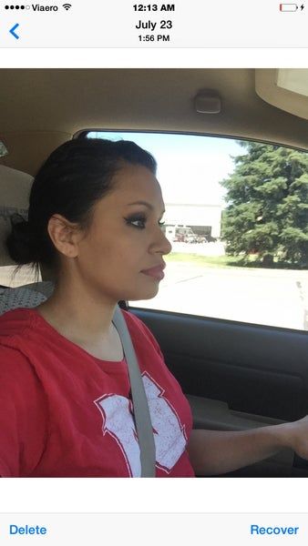 Quá trình tiêm Kybella điêu khắc vùng hàm và loại bỏ túi mỡ thừa lỏng lẻo dưới cằm