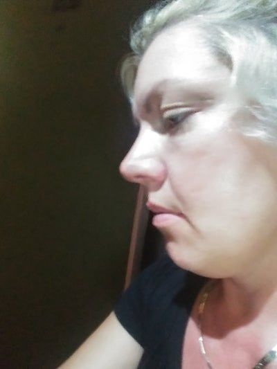 Khuôn mặt thon gọn, da mịn màng như da em bé sau khi làm Ultherapy ở bà mẹ 39 tuổi, 1 con