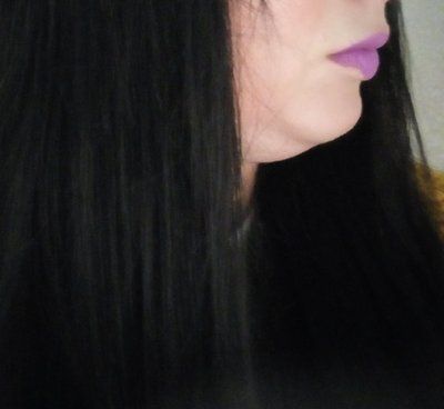Đường viền quai hàm và khuôn mặt cô gái thay đổi rõ rệt sau khi tiêm 2 lọ Kybella