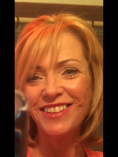 Quyết định căng da mặt sau một năm đắn đo