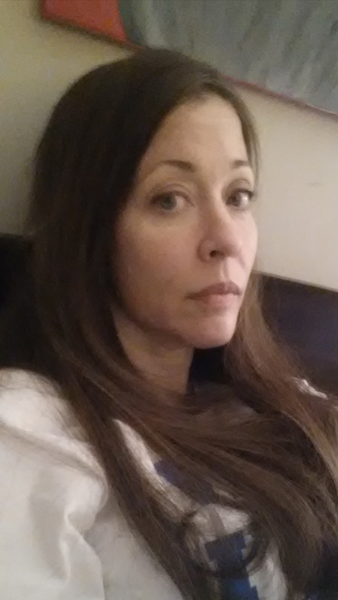 44 tuổi đã căng da mặt có sớm quá không?