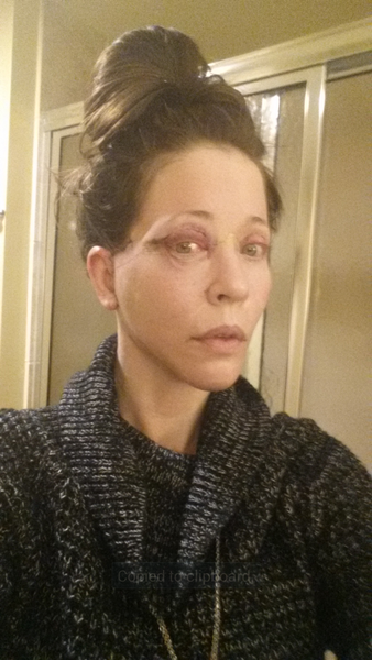 44 tuổi đã căng da mặt có sớm quá không?