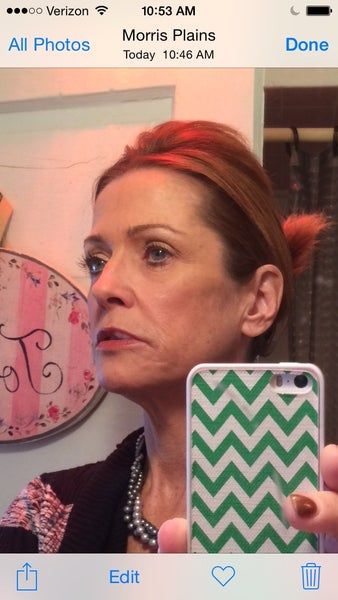 Quyết định căng da mặt sau một năm đắn đo